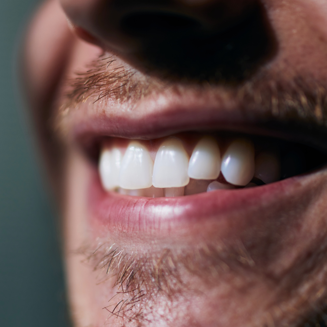 Are same-day dental implants safe?